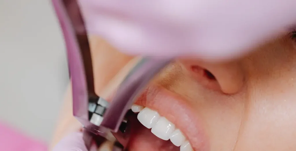 Gum Treatment in Islamabad